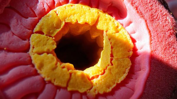 Aterosclérose : 6 faits essentiels à connaître sur cette maladie