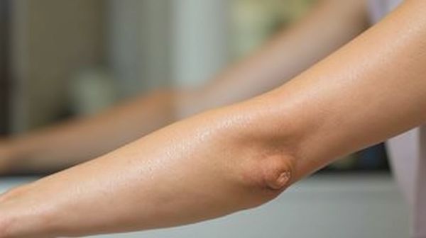 Épilation laser à La Rochelle : une peau lisse et sans poils